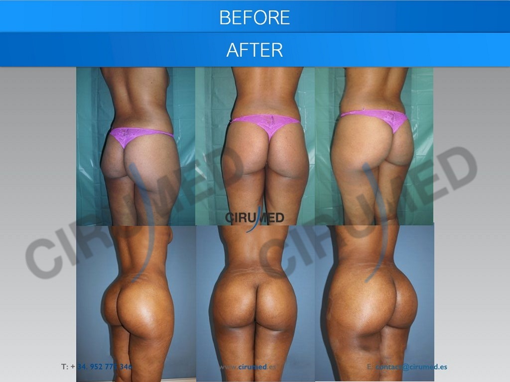 Before & After Photo